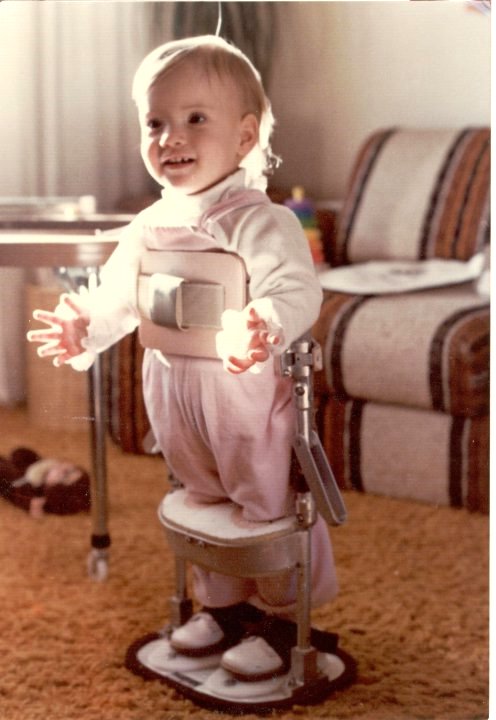 When I was a toddler, I would be placed in this device that would help me learn to bear weight on my legs. I otherwise would not have been able to do this because of the Spina Bifida. 